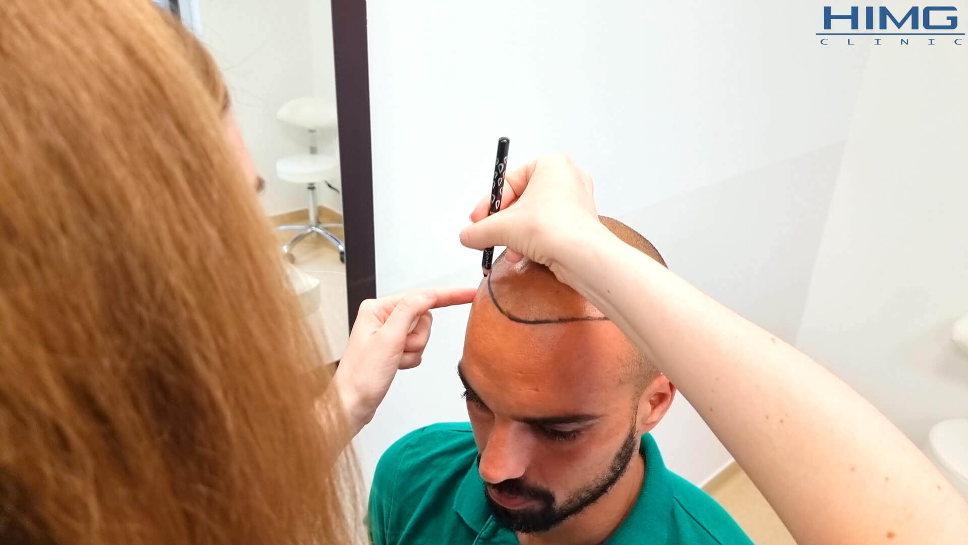 Miért nem mindegy, hogyan történik a hajvonal tervezése hajbeültetés során? - HIMG hajbeültetési klinika