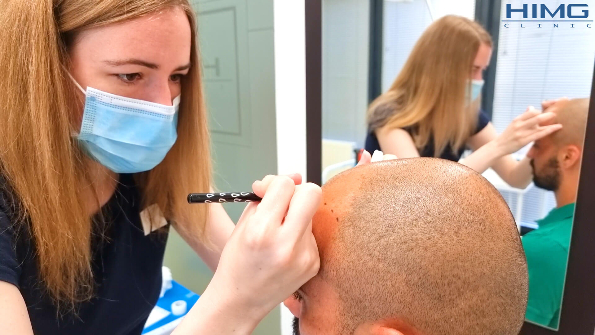 Miért nem mindegy, hogyan történik a hajvonal tervezése hajbeültetés során? - HIMG hajbeültetési klinika