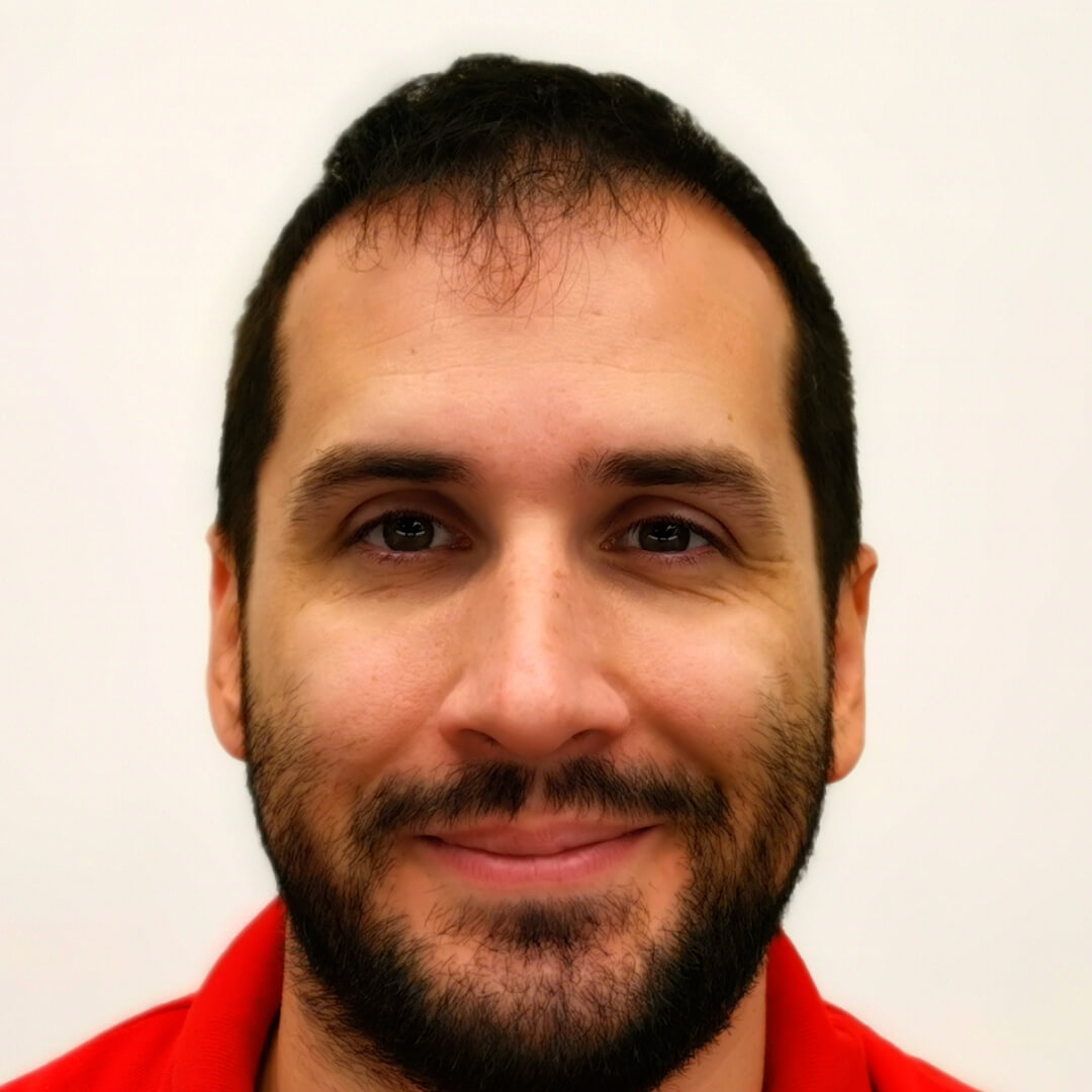 Kiss Norbert hajbeültetés előtt - HIMG hajbeültetési klinika