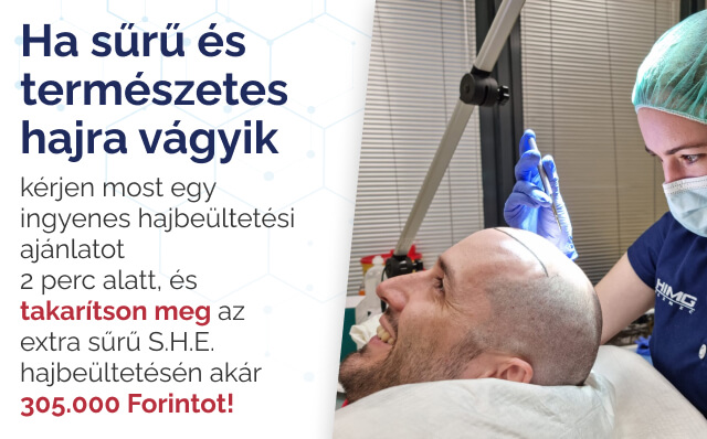 Hajbeültetés ingyenes ajánlat