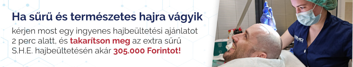 Hajbeültetés ingyenes ajánlat