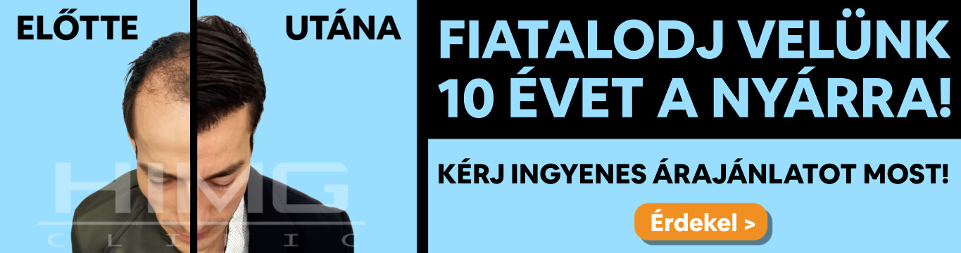 HIMG hajbeültetés akció