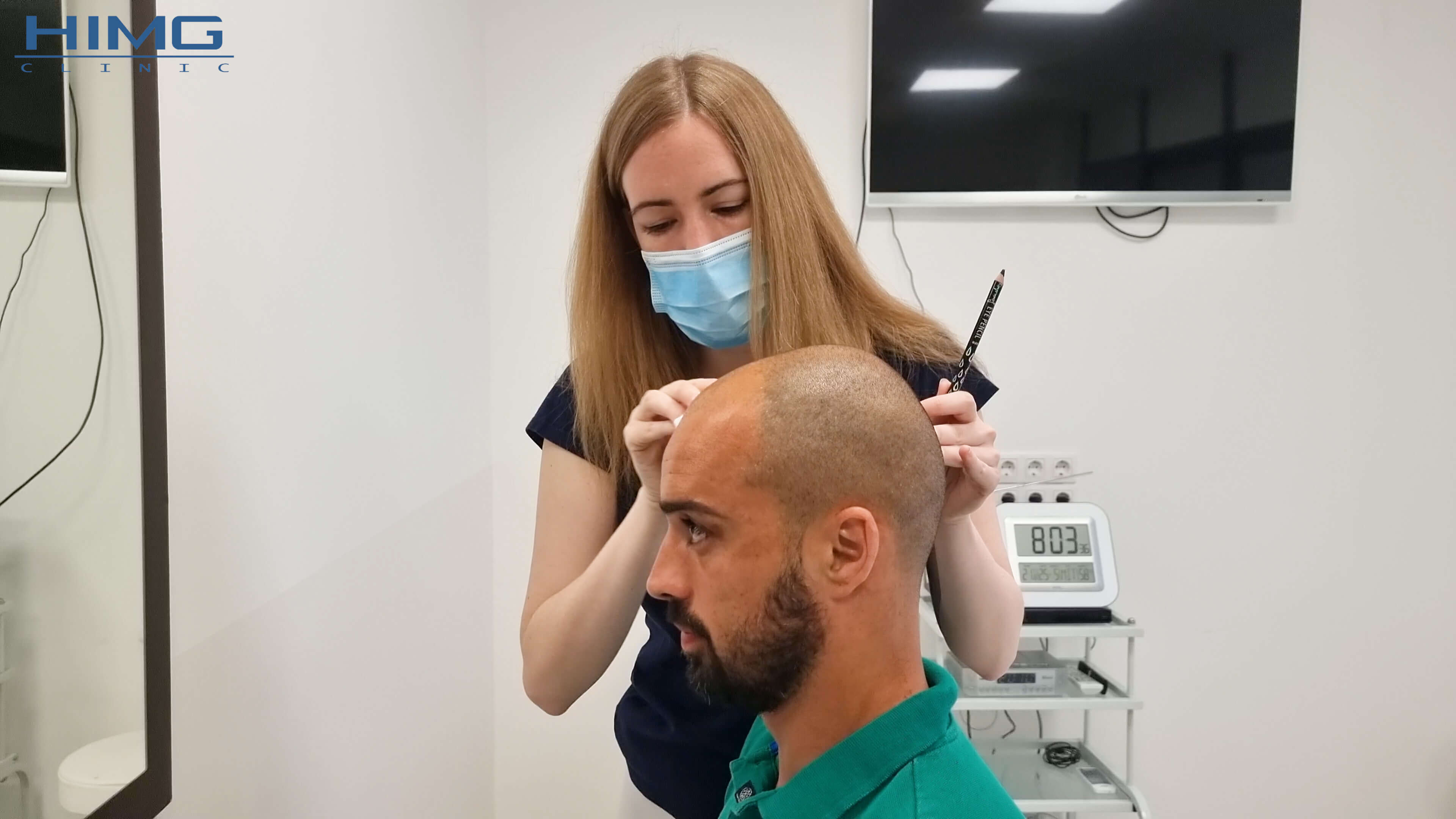 Fájdalmas-e a Hajbeültetés?