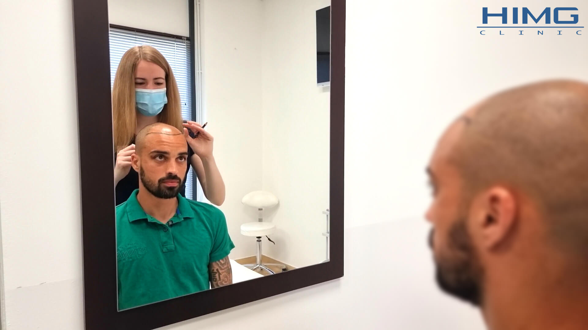 Hogyan érhető el természetes hajvonal a hajbeültetés során?