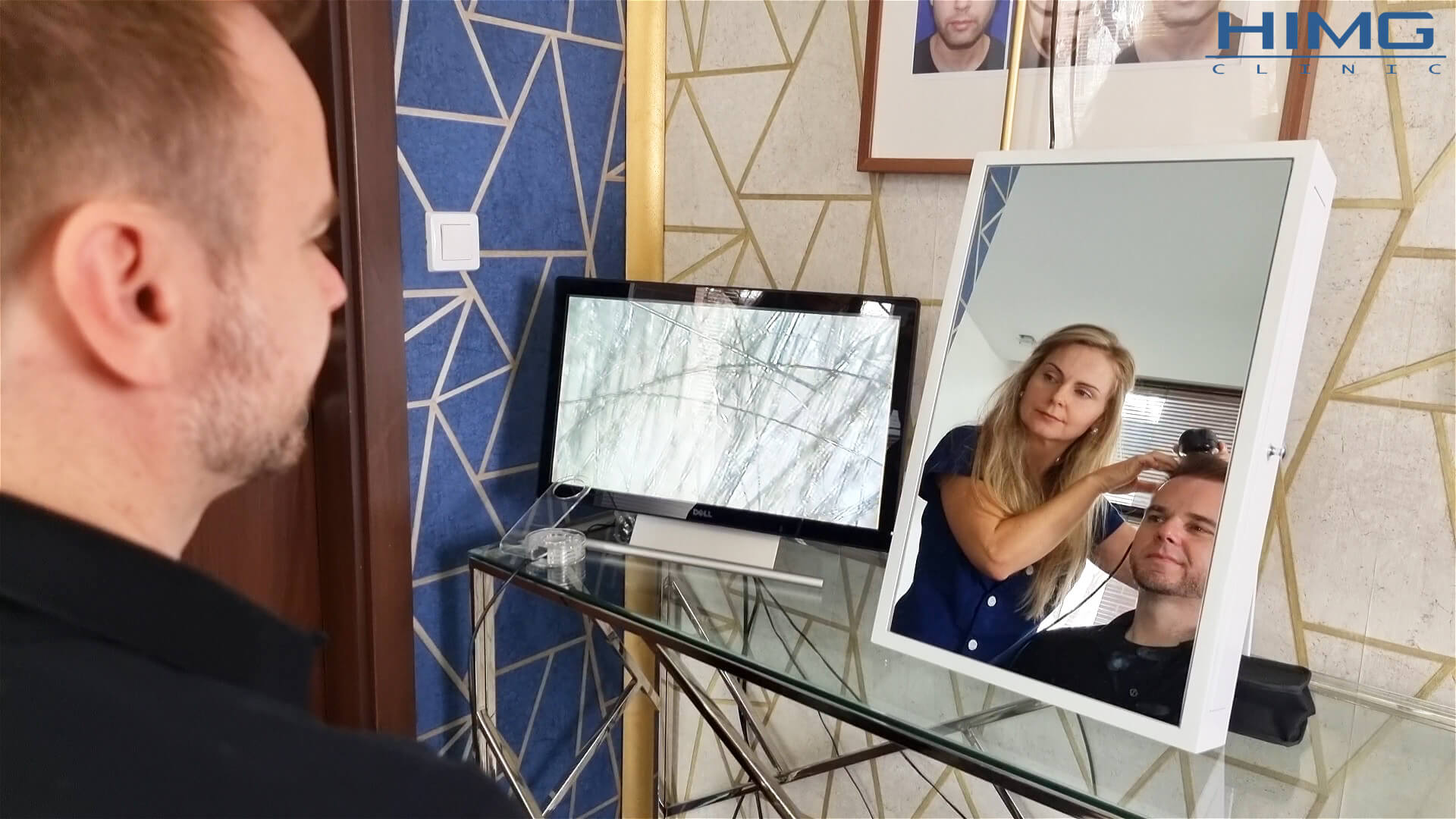 Mennyire tartós a Hajbeültetés?